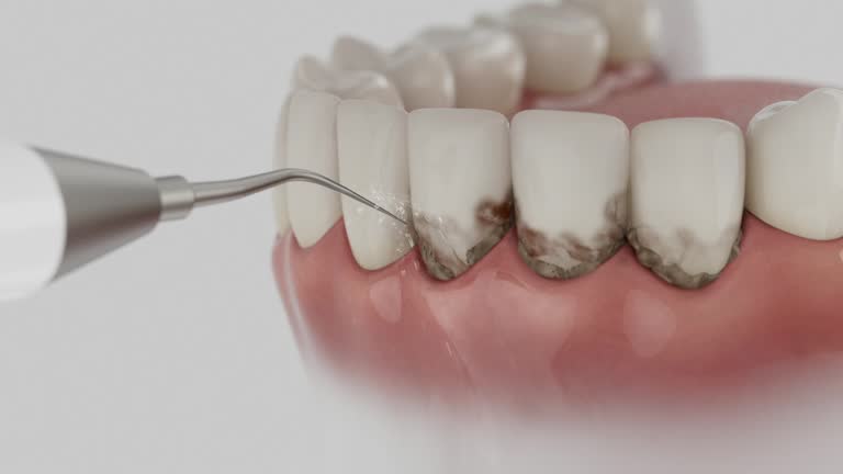 Reliable Dental Implants contractor in Dale, PA by Smile Center Dentistry